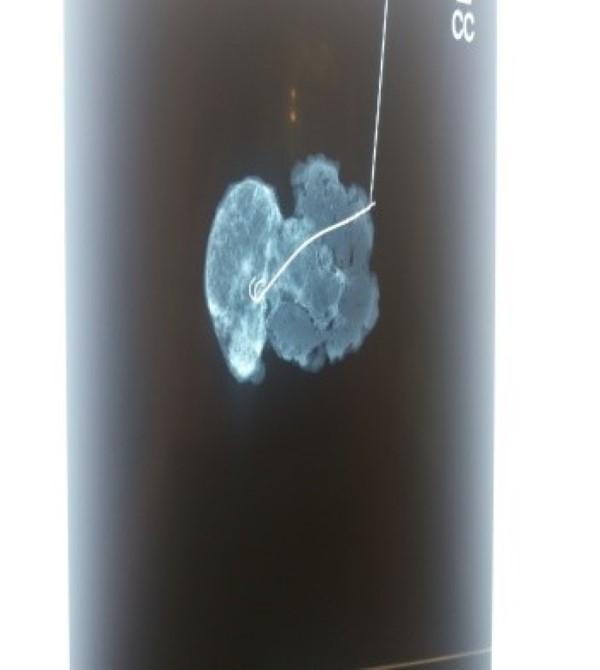 epasvstoseis-3